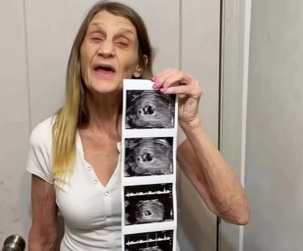 63-річна жінка, яка вийшла заміж за 26-річного хлопця, готується стати мамою